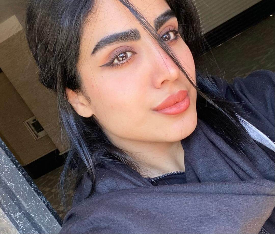 رعنا
