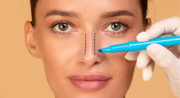 تکنیک‌های رایج در عمل بینی (رینوپلاستی) | مقایسه روش باز و بسته