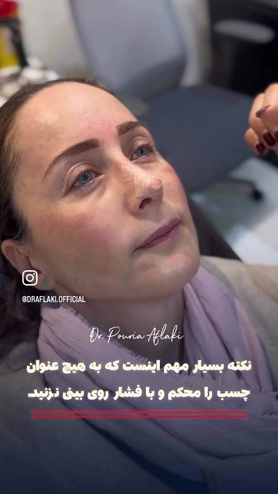 آموزش چسب زدن روی بینی
