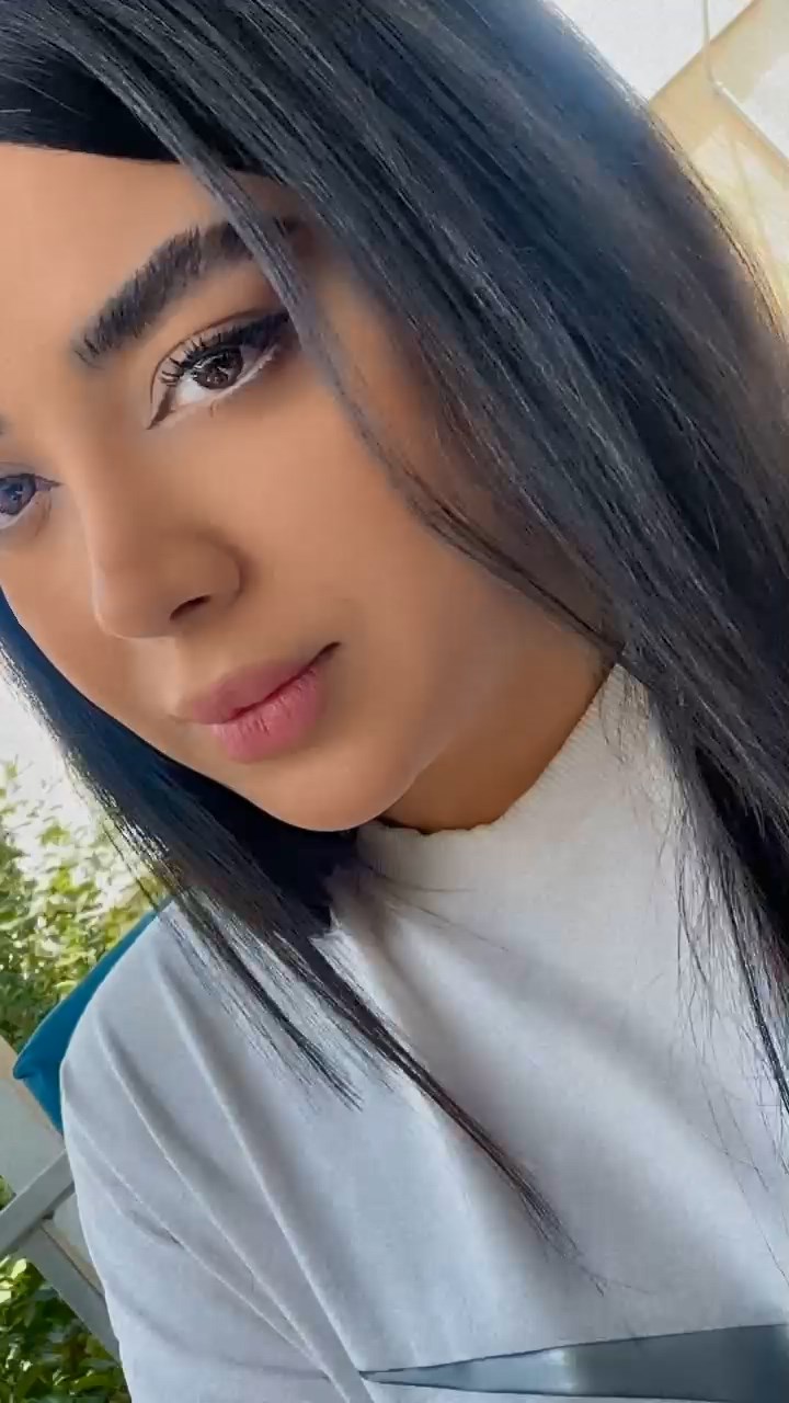 بینی گوشتی 8 ماه بعد از عمل زیبایی