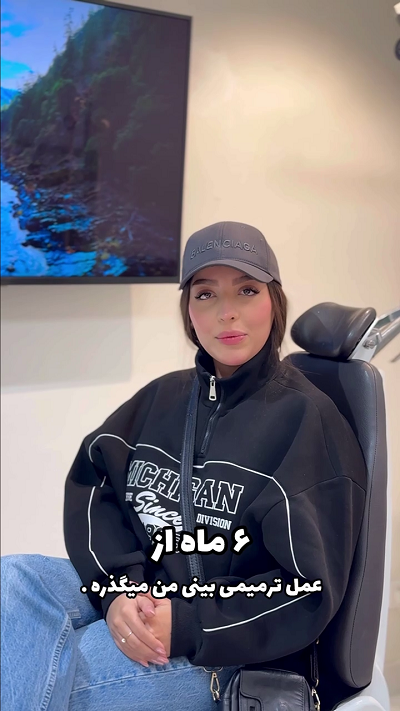 نتیجه عمل بینی بعد از 6 ماه