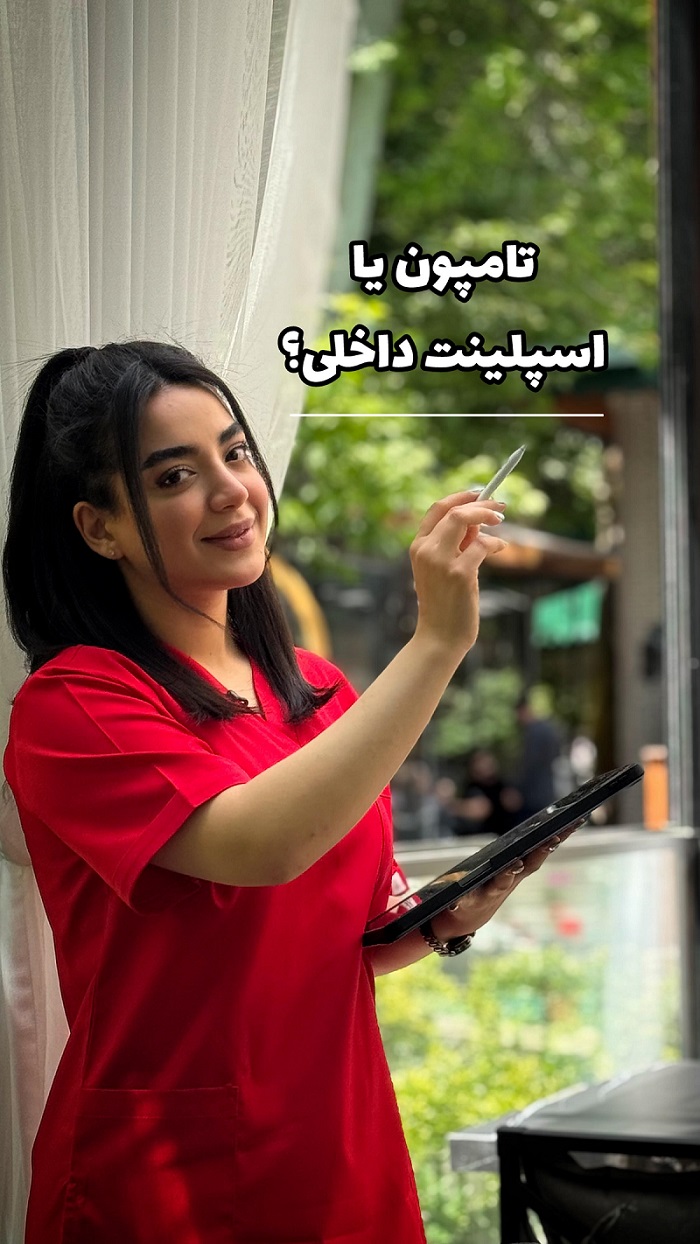 ویدیو اسپلینت یا تامپون