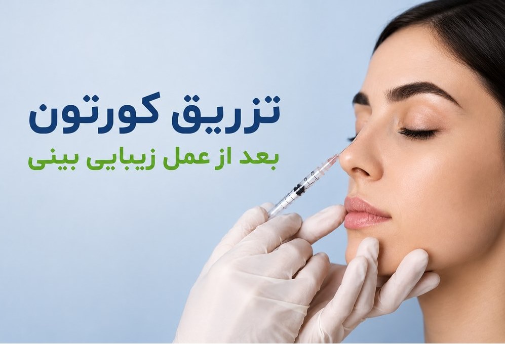 تزریق کورتون بعد از عمل زیبایی بینی